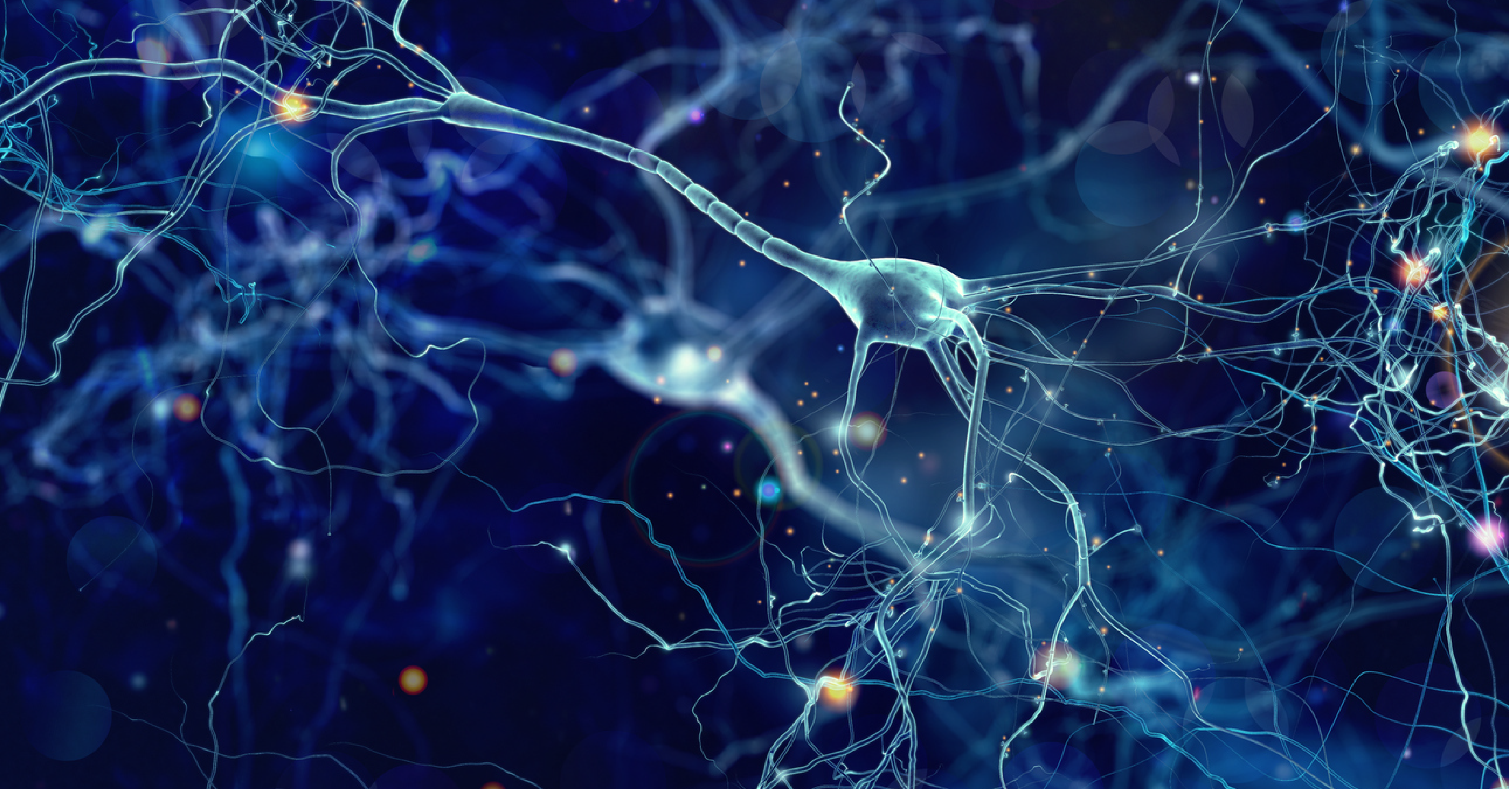 Computer-generated rendering of a series of interconnected brain cells with electrical pulses firing along dendrites